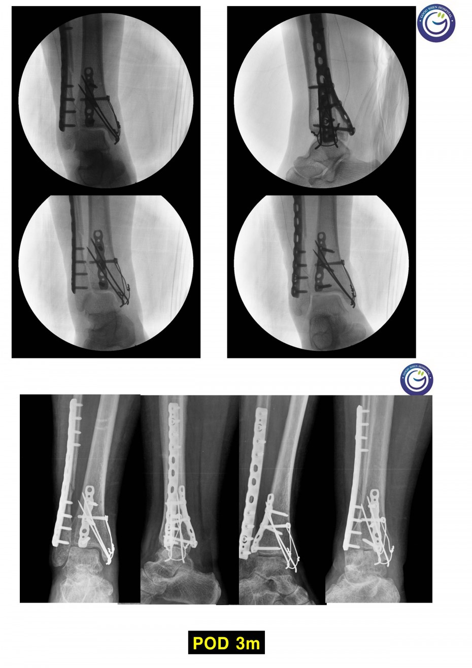 faf9c6ff6838b99917182d681fadbfc3_1516960